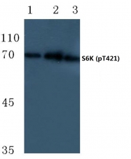 AP20853PU-N - RPS6KB1 / STK14A