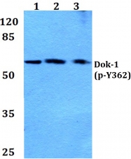AP20860PU-N - DOK1 / p62 dok