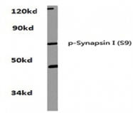 AP20870PU-N - Synapsin-1