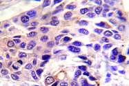 AP20890PU-N - GSK3 alpha