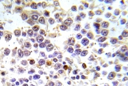 AP20893PU-N - Histone H3.1