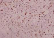 AP20960PU-N - NMDA Receptor 1