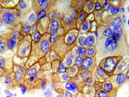AP20971PU-N - EGFR / ERBB1