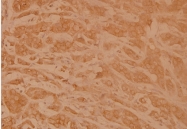 AP21086PU-N - SMAD1