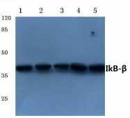 AP21089PU-N - NFKBIB / IKBB
