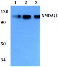 AP21091PU-N - NMDA Receptor 1