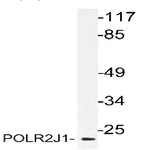 AP21166PU-N - POLR2J