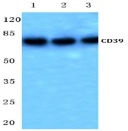 AP21170PU-N - CD39 / ENTPD1