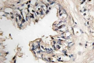 AP21194PU-N - MRPS36