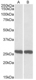 AP21292PU-N - UCHL1 / PGP9.5