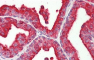 AP21364AF-N - ACPP / Prostatic acid phosphatase