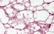 AP21459SU-N - Complement C3c