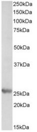 AP21517PU-N - PSMB4 / PROS26
