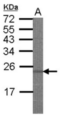 AP22367PU-N - EIF3A / EIF3S10