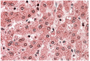 AP22390PU-N - ALDH5A1 / SSADH