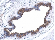 AP22398PU-N - MAPK4 / ERK4