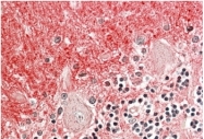 AP22428PU-N - Transducin beta chain 3 (GNB3)