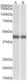 AP22441PU-N - Isocitrate dehydrogenase / IDH