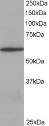AP22532PU-N - Coronin-1A