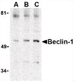 AP22863PU-N - Beclin-1