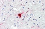 AP22875PU-N - Neuropeptide Y / NPY