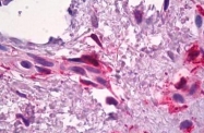 AP22898PU-N - Coagulation factor XIIIa (F13A1)