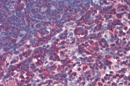 AP22942PU-N - Caspase-8 / FLICE