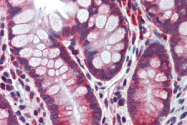 AP22942PU-N - Caspase-8 / FLICE