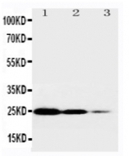 AP23346PU-N - CD120a / TNFR1