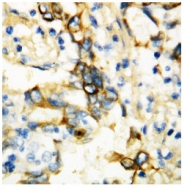 AP23346PU-N - CD120a / TNFR1