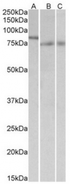 AP23663PU-N - IRF2BP1