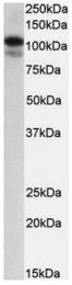 AP23696PU-N - SATB1
