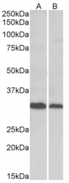 AP23757PU-N - DNA primase small subunit