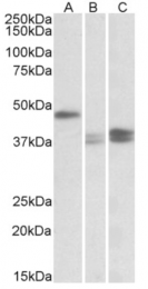 AP23763PU-N - TXNDC5 / TLP46