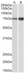 AP26011PU-N - XPNPEP1