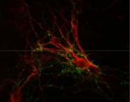 AP26436PU-N - Synapsin-1