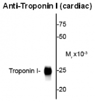 AP26440SU-N - Cardiac Troponin I