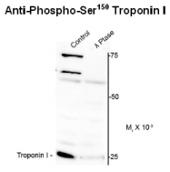 AP26441PU-N - Cardiac Troponin I