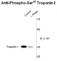 AP26443PU-N - Cardiac Troponin I