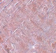 AP30705PU-N - RANBP10
