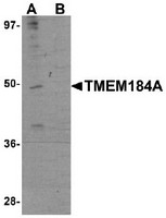 AP30911PU-N - TMEM184A