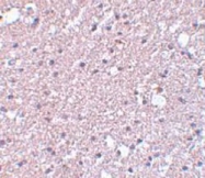 AP30911PU-N - TMEM184A