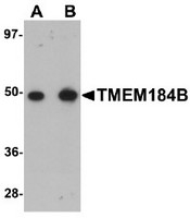 AP30912PU-N - TMEM184B