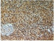 AP31057PU-N - TRAIP / RNF206