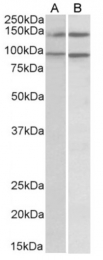 AP31062PU-N - ARHGEF18