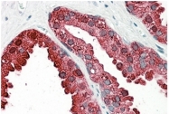 AP31101PU-N - ACPP / Prostatic acid phosphatase