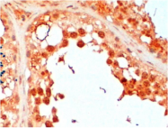 AP31108PU-N - UBE2R2