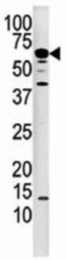AP31352PU-N - PPP3CA / Calcineurin A