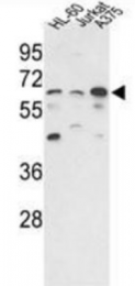 AP31353PU-N - PPP3CC / CALNA3