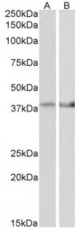 AP31421PU-N - Isocitric dehydrogenase beta / IDH3B
